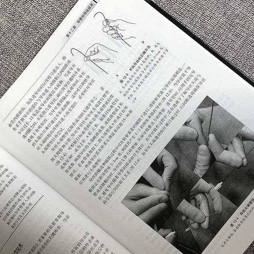 正版现货 脑血管病介入治疗学第2版二版(精)刘新峰 内科 临床实用医学书籍可搭配脑血管病和神经介入技术学指南手册人民卫生出版社 商品图3