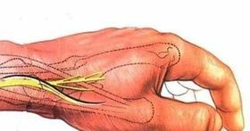  手脚经常麻木？是风、寒、湿、邪毒侵扰的信号！若不重视，后果很严重！ 