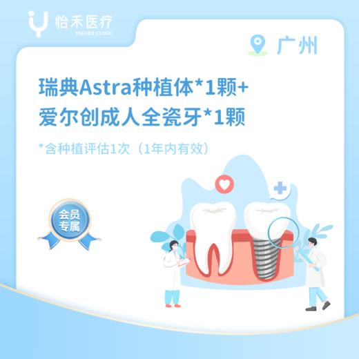 广州【会员】瑞典Astra种植体*1颗+爱尔创成人全瓷牙*1颗 商品图0
