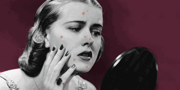 买100支祛痘印产品，不如先看这篇才不踩雷