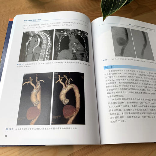 胸外科疑难病例50例 商品图3