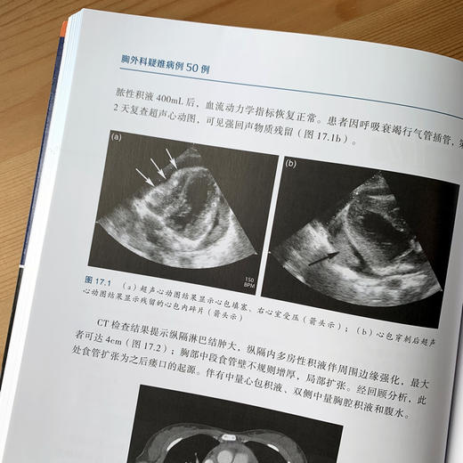胸外科疑难病例50例 商品图2