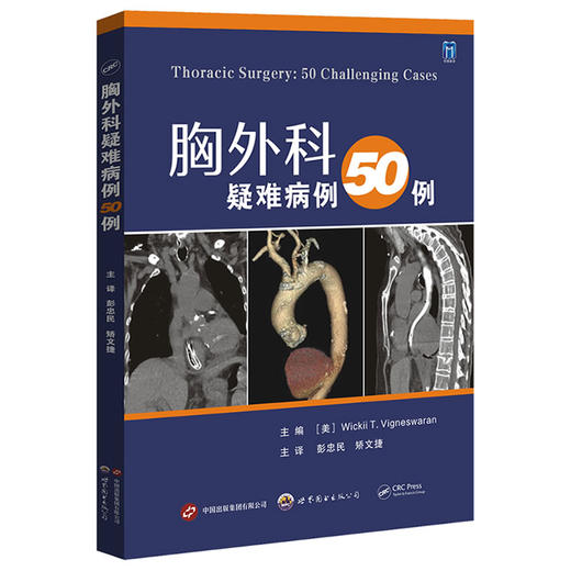 胸外科疑难病例50例 商品图0