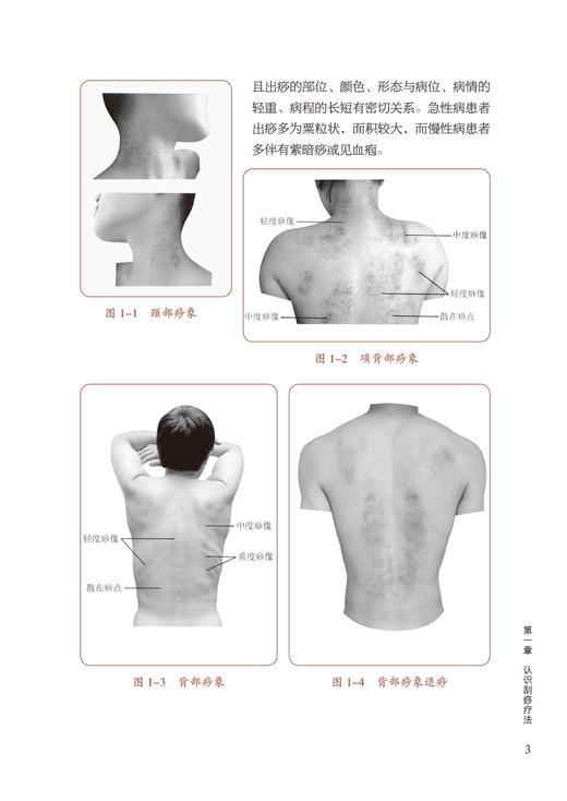 中医刮痧疗法 中医外治特色疗法临床技能提升丛书 郭长青 主编 刮搓疗法 刮痧取穴特点操作方法 中国医药科技出版社9787521426588 商品图3