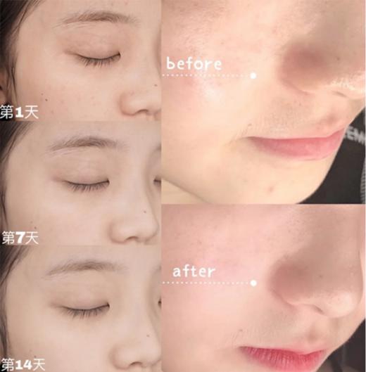【枫缇全能面霜补血草特润高光修护面霜】🔥【买一送一】💥超值特惠，紧致肌肤，平滑弹嫩，以油入霜，特润保湿，提亮肌肤,四季可用的全能精油面霜 商品图3