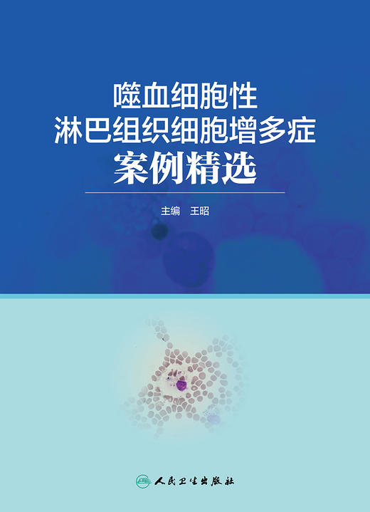 噬血细胞性淋巴组织细胞增多症案例精选 2023年7月参考书 9787117342391 商品图1