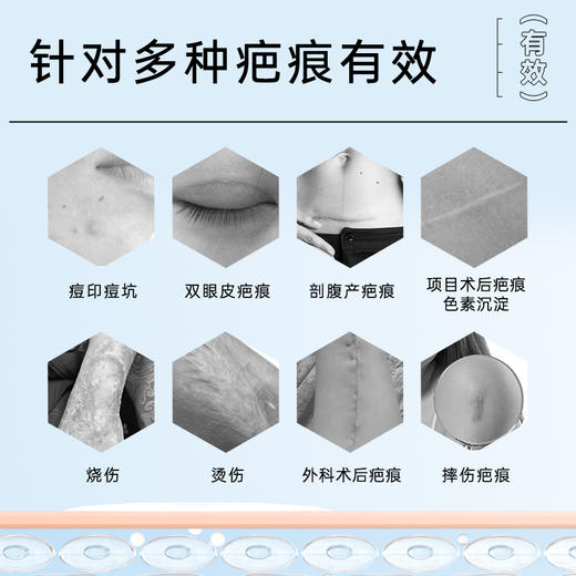 美卿医用胶原蛋白硅酮舒痕凝胶 商品图6
