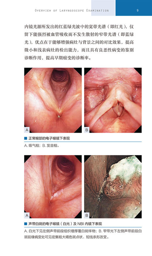咽喉疾病喉镜图鉴 陶磊NBI内镜图嗓音功能性疾病频闪喉镜视频咽炎急性扁桃体炎用耳鼻喉头颈外科学手术人民卫生出版社耳鼻喉科书 商品图4