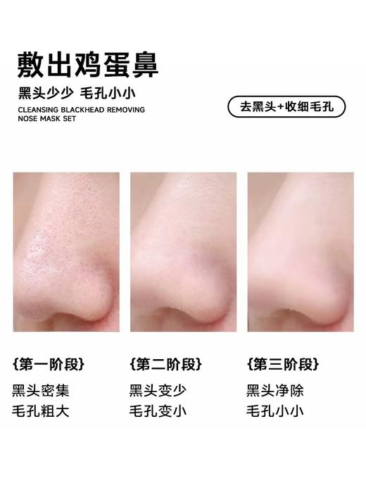 柏翠丝·净护去黑头导出鼻膜套盒 去闭口粉刺男女深层清洁围剿草莓鼻鼻贴 (送黑头铲) · (6对装) 商品图2