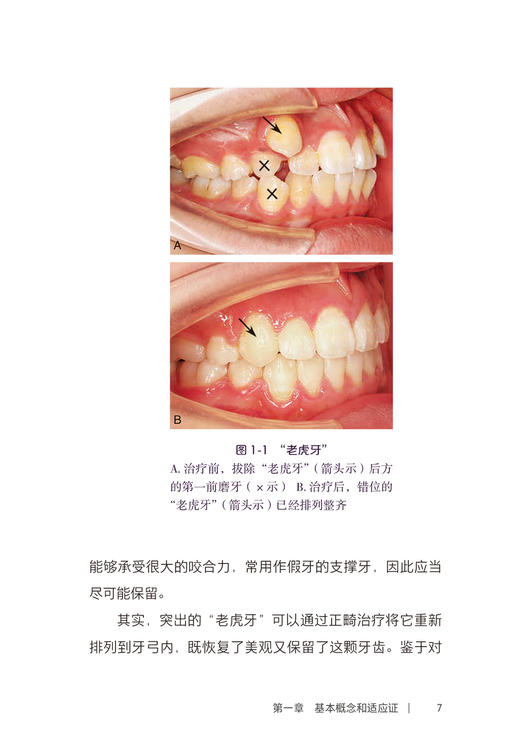 口腔自我保健视频漫画丛书 正畸篇 房兵 附视频 口腔正畸适应证病因预防知识科普 矫治时机流程矫治器9787117348812人民卫生出版社 商品图3