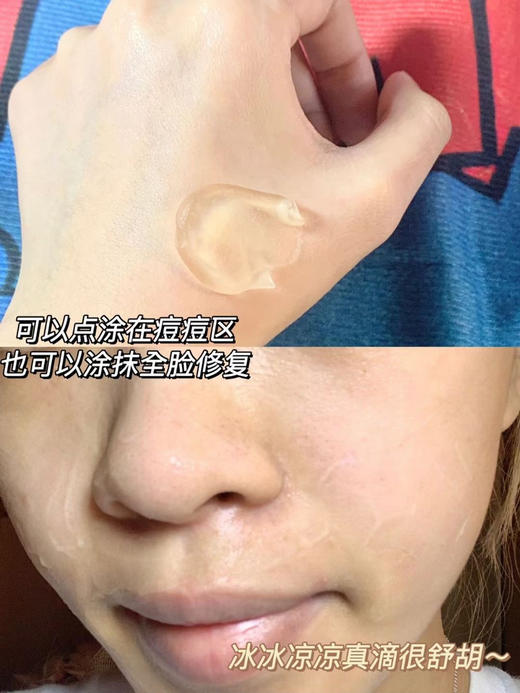 C咖皮傲宁水杨酸祛痘小罐膜 5g 涂抹式面膜淡化痘印 商品图3