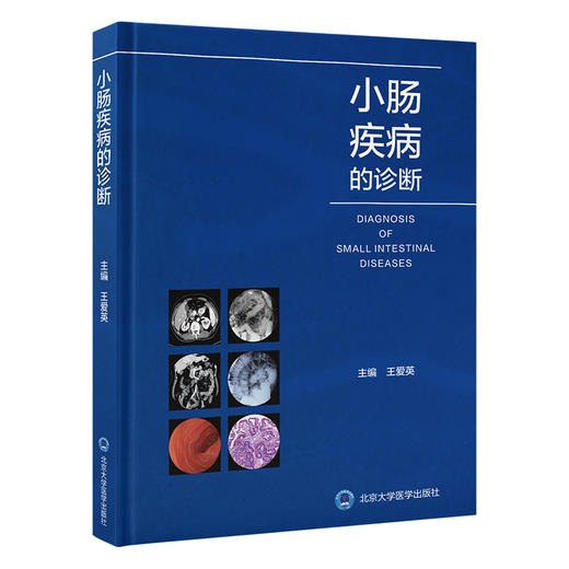 小肠疾病的诊断 王爱英 疾病病因病理临床表现造影CT诊断 典型病例 消化科等相关学科医师参考书 北京大学医学出版社9787565926853 商品图1