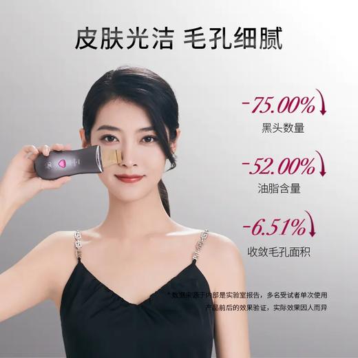 玛瑞莎 宙斯超声波ems电动黑头铲去黑头毛孔清洁家用黑头仪（不支持退换）[福利品] 商品图1