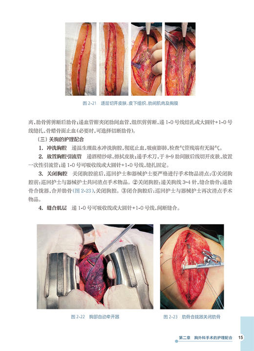 肿瘤外科规范化手术配合 何瑞仙 肿瘤手术全过程操作步骤 手术护理配合方法标准 隔离技术操作规范 人民卫生出版社9787117348256 商品图4