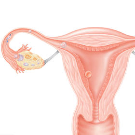 卵泡监测（2次）