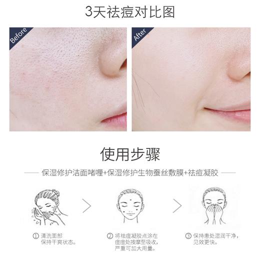 伊肤泉清透祛痘凝胶 15ml支 商品图2