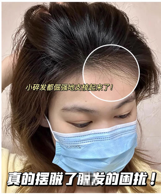 【清仓好价】Spes澳雪防兑密发精华液3ml*12支 商品图5