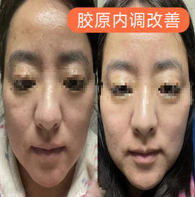 【Alinda私人定制】抗老提亮内调外促个案