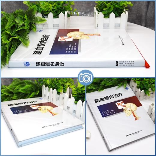 脑血管内治疗+中国脑血管病临床管理指南 第2版 脑血管内治疗的准备掌握脑血管造影设备的使用方法导引导管引导困难的应对实例等 商品图4