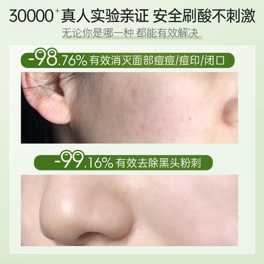 儒意水杨酸控油清肌棉片52片/1瓶 刷酸去闭口粉刺 祛痘痘印  清洁收缩毛孔  | 儒意官方商城 商品图1