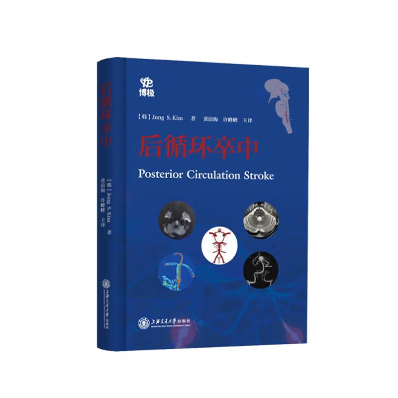 后循环卒中