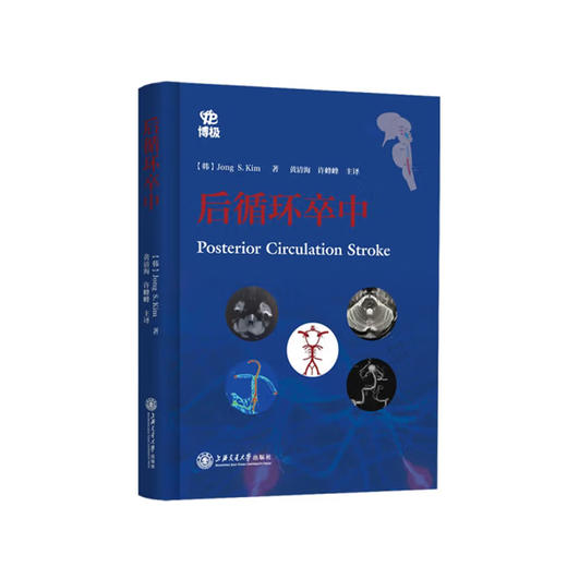 后循环卒中 商品图0