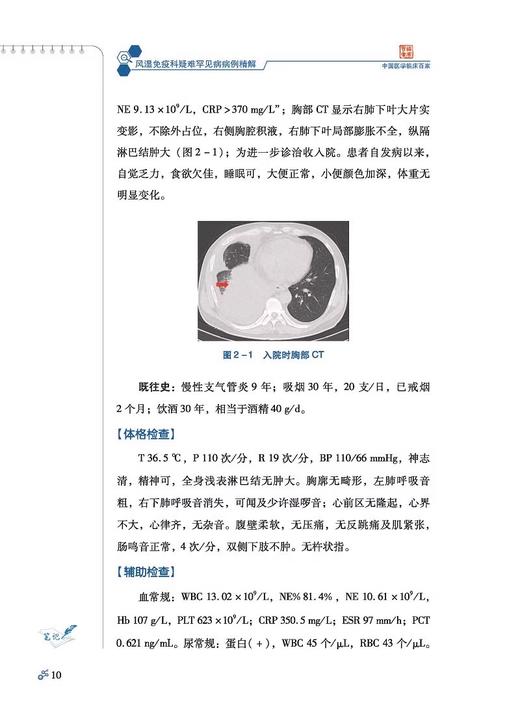 风湿免疫科疑难罕见病病例精解 穆荣 李胜光等 发热 关节痛和腰背痛 胸腹痛 蛋白尿 血细胞减少 口眼鼻症状 科学技术文献出版社 商品图3