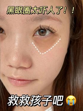 日本爆火淡黑眼圈按摩法！对抗眼部衰老不走弯路！
