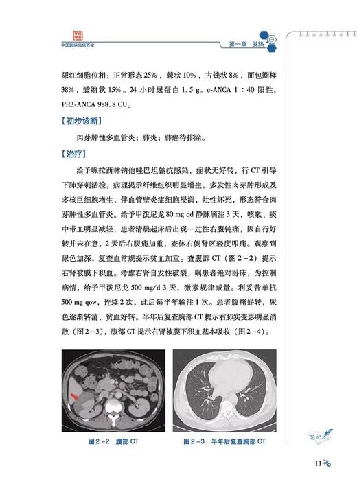 风湿免疫科疑难罕见病病例精解 穆荣 李胜光等 发热 关节痛和腰背痛 胸腹痛 蛋白尿 血细胞减少 口眼鼻症状 科学技术文献出版社 商品图4