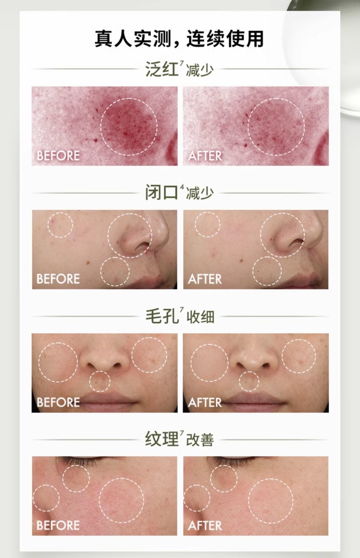 O1CN01UM2Txq1Q7WsSUUdsm_!!2113741929.jpg (1500Ã�2322)