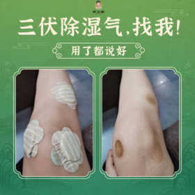  灸治百病不是神话，但不懂这些常识，艾灸10年也白搭 