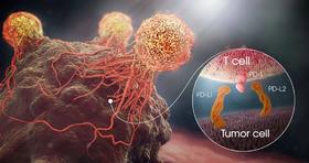  ​一灸补阳、二灸化阴、三灸强免疫，肿瘤自然消！ 