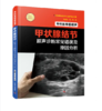 外科医师看超声：甲状腺结节超声诊断常见错误及原因分析 商品缩略图0
