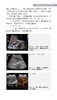 肝肾移植的超声监测入门 肖春华 李鸿 李永峰 主编 肝肾脏移植术超声波诊断检查技巧方法 肝肾移植术前准备及术后超声监测书写报告 商品缩略图4