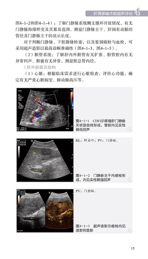 肝肾移植的超声监测入门 肖春华 李鸿 李永峰 主编 肝肾脏移植术超声波诊断检查技巧方法 肝肾移植术前准备及术后超声监测书写报告 商品图4