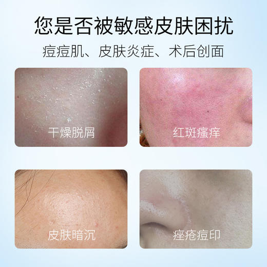 民医用皮肤修复冷敷贴医美术后皮肤修复贴面部红斑皮炎痤疮医用面部修复膜痘痘肌敏感肌保湿皮肤疤修复敷料 一盒装【5片】 商品图6