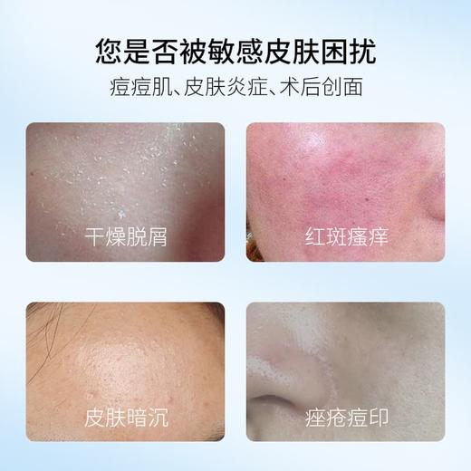 万民医用皮肤液体敷料 械字号 医用术后皮肤面部红斑皮炎痤疮医用面部修复膜痘痘肌敏感肌保湿 50g/瓶 商品图2