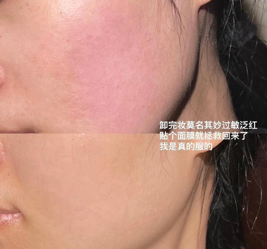 【清仓好价】神秘博士二裂酵母精华发酵面膜10片 商品图5