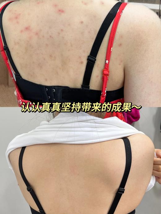 【应季好物】日本VSKA暴汗足贴10片/包*6包 商品图5