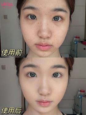 💕约会变美小技巧-瑕疵消失术