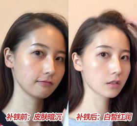 女人缺铁老得快？每天2片它，面色红润气色好，化妆品钱都省了！今日5折优惠！