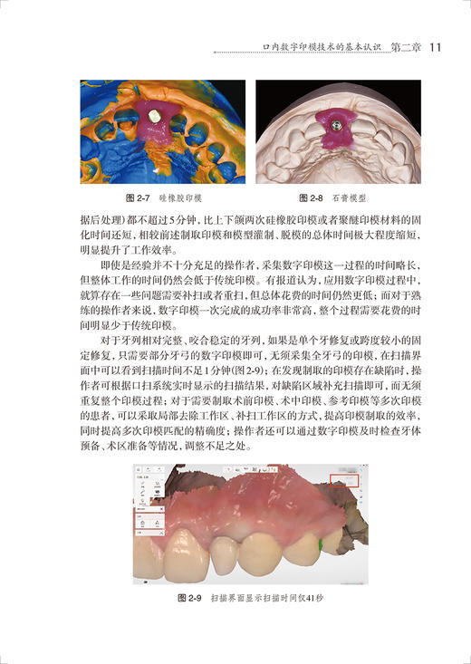 口内数字印模技术 口腔美学修复实用教程 刘峰 余涛 临床口内数字印模技术操作流程及技巧 口腔科学 人民卫生出版社9787117350648 商品图3