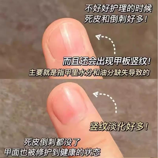 【8.12积分当钱花】ZFB臻润手足精华由10ML 商品图4