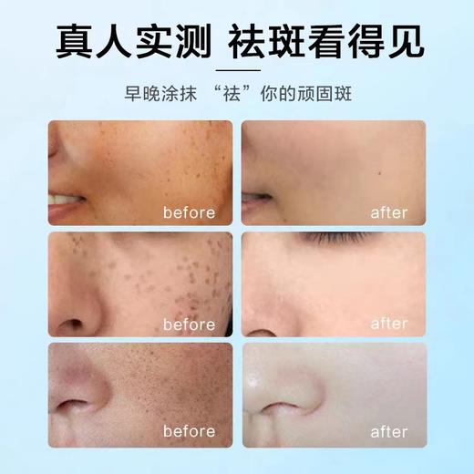 爱心净润美白祛斑霜熊果苷烟酰胺淡化黑色素晒斑保湿修护男女通用  全新升级 商品图4