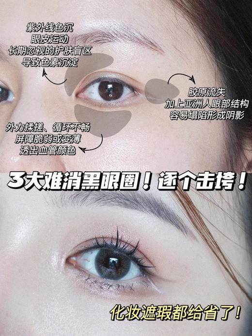 【清仓好价】德国Freiol凝时紧致眼霜15ml（效期至24.6） 商品图2