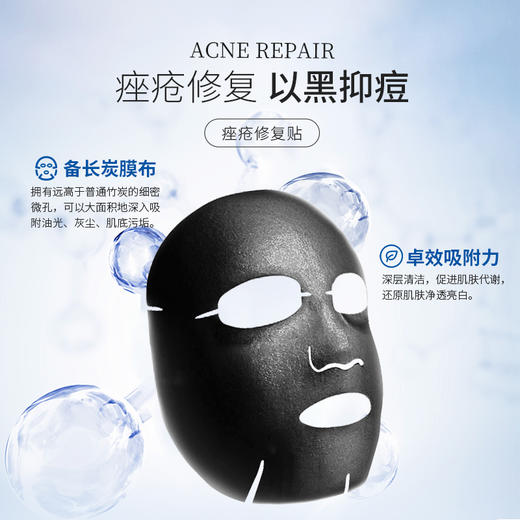 【入会立享折扣】复因FOY医用透明质酸钠修复贴（黑膜）医用 痤疮修复 清洁毛孔 减少色沉 商品图4