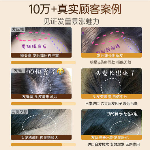 【🔥低至￥29.75/件|119选4件|9月超级会员日】育发液头发际线护理精华营养液剂快速增发密发男女生长防脱发正品 商品图3