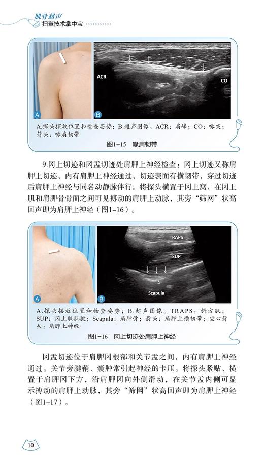 肌骨超声扫查技术掌中宝 附视频 李嘉 史进军 杨斌 等编 肌骨关节超声扫查技术掌中宝 肌肉骨骼超声扫查口袋书 科学技术文献出版社 商品图4