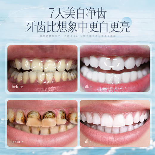 儒意清新炫白护龈牙膏120g 去黄去口臭美白速效洗白 | 儒意官方商城 商品图1