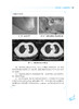 中医内科学 风湿分册 刘维 茅建春 国家健康委员会十三五规划教材 全国中医住院医师规范化培训教材 人民卫生出版社9787117341301 商品缩略图3